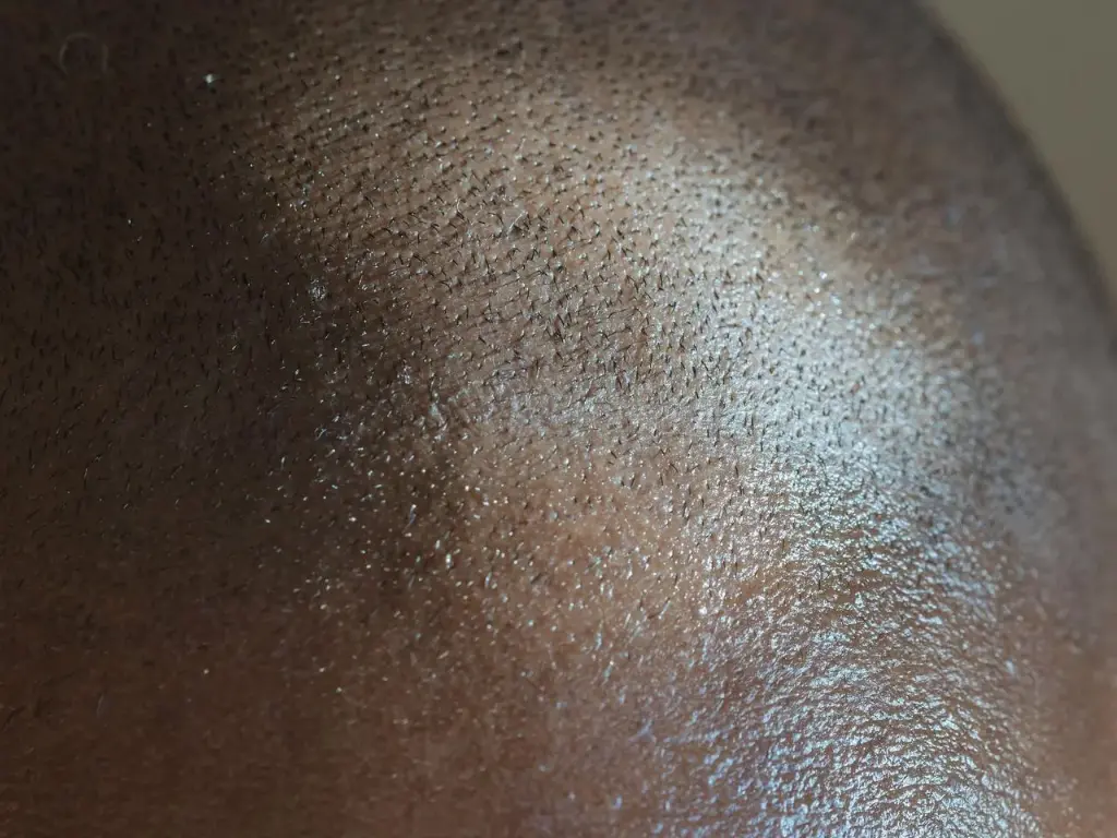 Gentle Scalp Cleanse for Kids