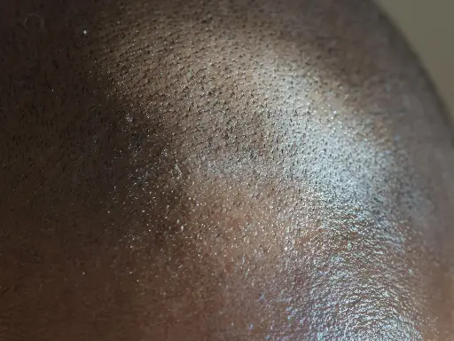 Gentle Scalp Cleanse for Kids