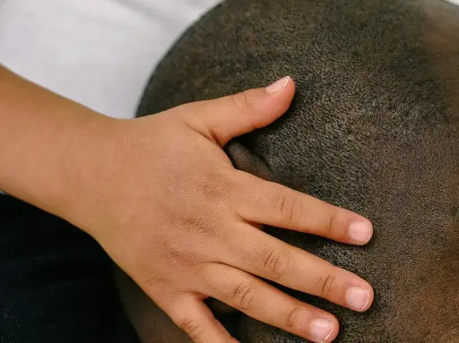 Scalp Recovery Therapy