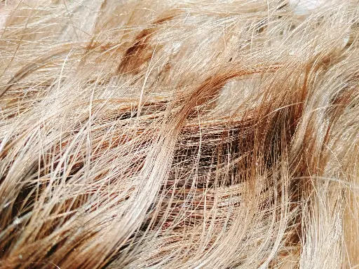 Hair Follicle Density Assessment
