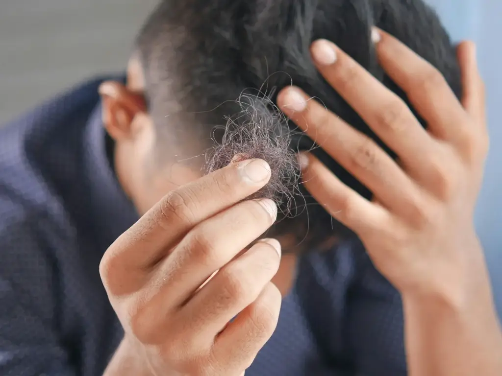 Anti-Hair Loss Therapy