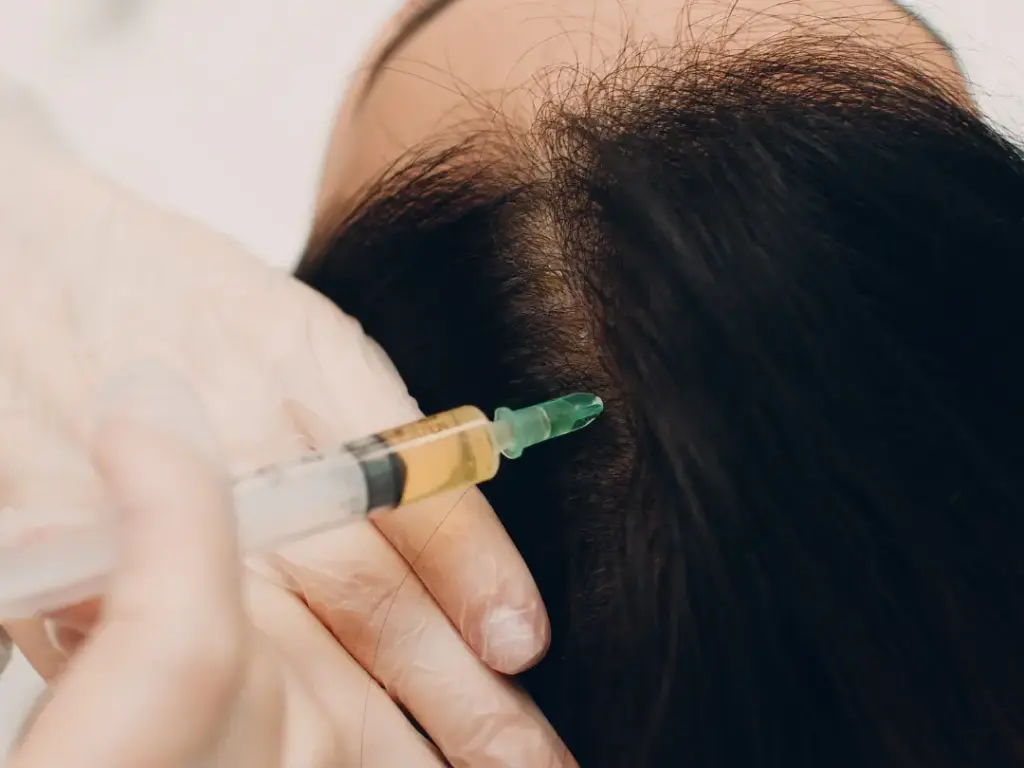 PRP (Platelet-Rich Plasma) Therapy